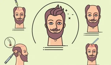 579038800-2_1-360x212